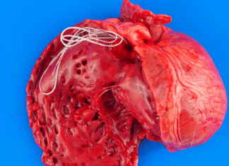 This deadly dog ‘spaghetti’ has ancient origins This deadly dog ‘spaghetti’ has ancient origins