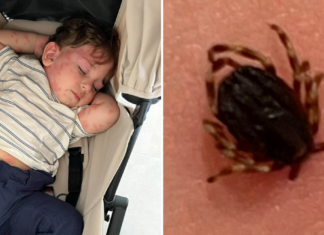 Diaz, 1, blev biten av en jättefästing på solsemestern Diaz, 1, blev biten av en jättefästing på solsemestern