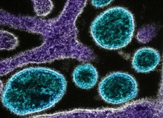 Tudo o que precisa de saber sobre o vírus Nipah Tudo o que precisa de saber sobre o vírus Nipah