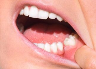 Un nou biomatrrial permite regenerarea dinților în laborator Un nou biomatrrial permite regenerarea dinților în laborator