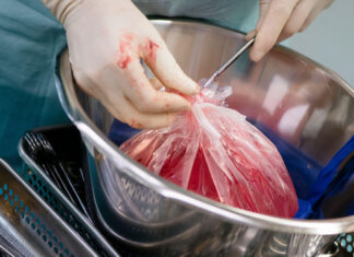 CMS Makes Push to Maximize Donor Organs, Even the Imperfect Ones CMS Makes Push to Maximize Donor Organs, Even the Imperfect Ones