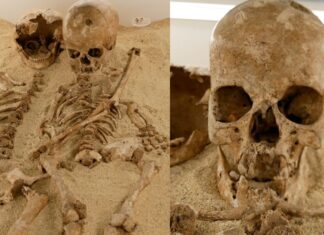 Teenage girl who lived in Italy 12,000 years ago had a rare form of dwarfism, DNA study shows Teenage girl who lived in Italy 12,000 years ago had a rare form of dwarfism, DNA study shows