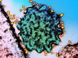 No vaccines, no cure, and ‘very dangerous’. Should we be worried about Nipah virus?