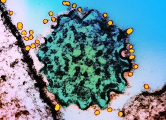 No vaccines, no cure, and ‘very dangerous’. Should we be worried about Nipah virus? No vaccines, no cure, and ‘very dangerous’. Should we be worried about Nipah virus?