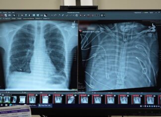 Doctors keep patient alive using ‘artificial lungs’ for two days Doctors keep patient alive using ‘artificial lungs’ for two days