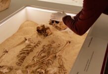 Skeletons reveal Stone Age mother and daughter had a rare genetic condition Skeletons reveal Stone Age mother and daughter had a rare genetic condition