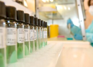 “Es una enfermedad tremendamente infecciosa”: un experto advierte de la presencia de sarampión en España “Es una enfermedad tremendamente infecciosa”: un experto advierte de la presencia de sarampión en España