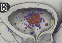 ‘Very Impressive’ Survival With Combo in First-Line Prostate Cancer Study ‘Very Impressive’ Survival With Combo in First-Line Prostate Cancer Study