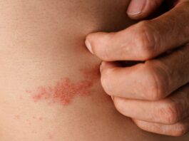 Patient bizarre : sa vessie est tellement pleine qu’elle se rompt, une complication rare d’une maladie fréquente